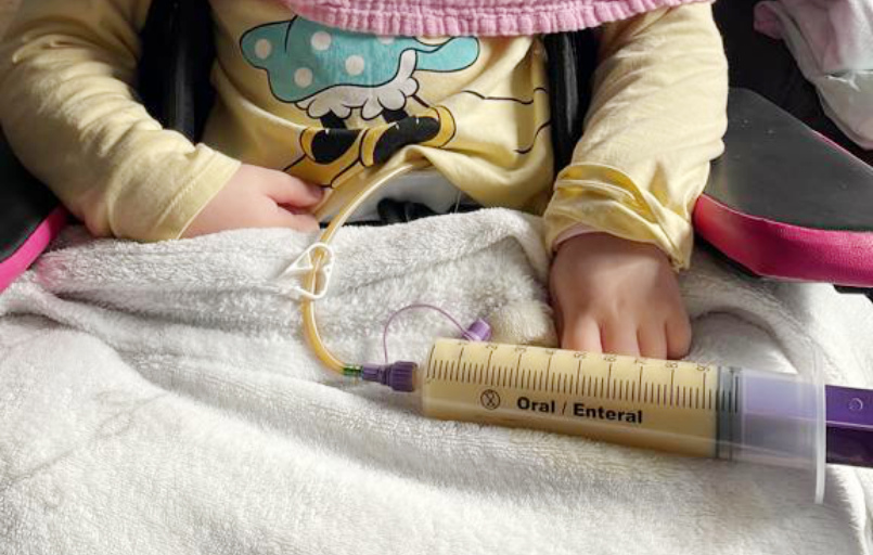 Sondennahrung Kinder FiNiFuchs Sondennahrung Kinder FiNiFuchs